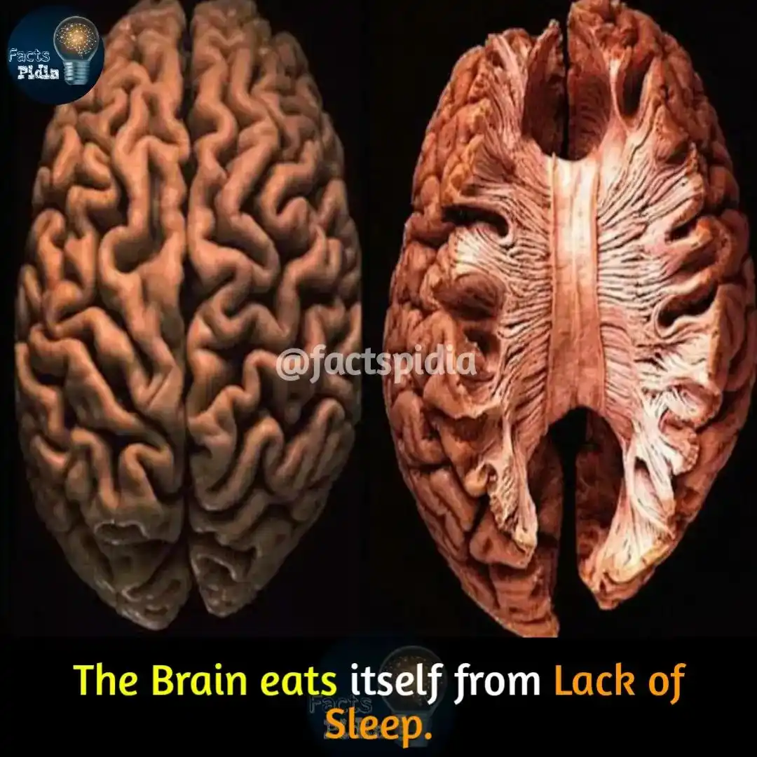 Exploring the mysteries of the brain