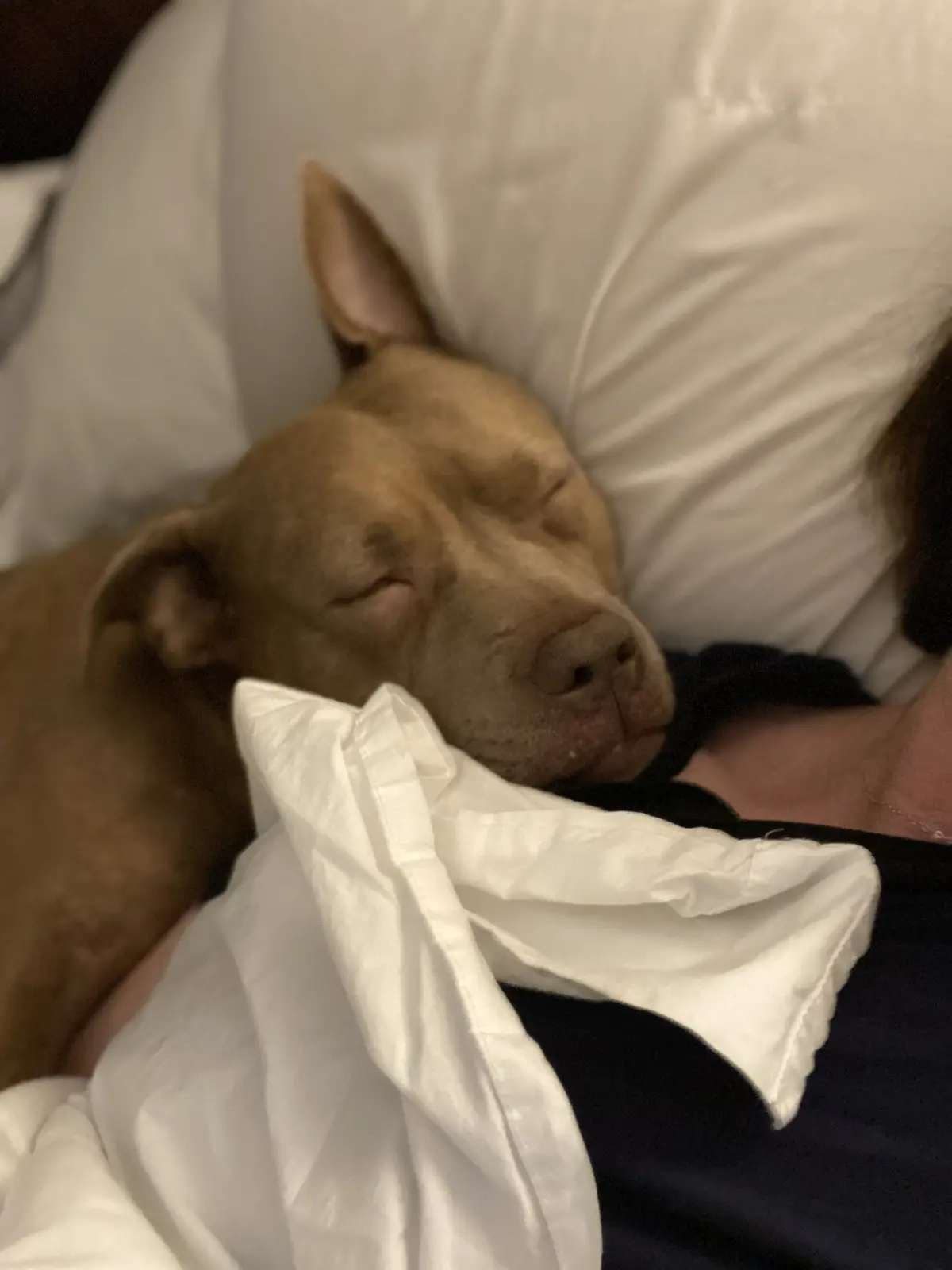 A brown dog with closed eyes is sleeping peacefully on a white pillow, nestled against a person's arm and partially covered…